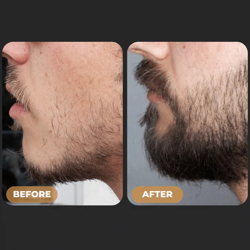 SPARTAN™ - Root Activator Spray & Beard Growth Bundle - Image 5