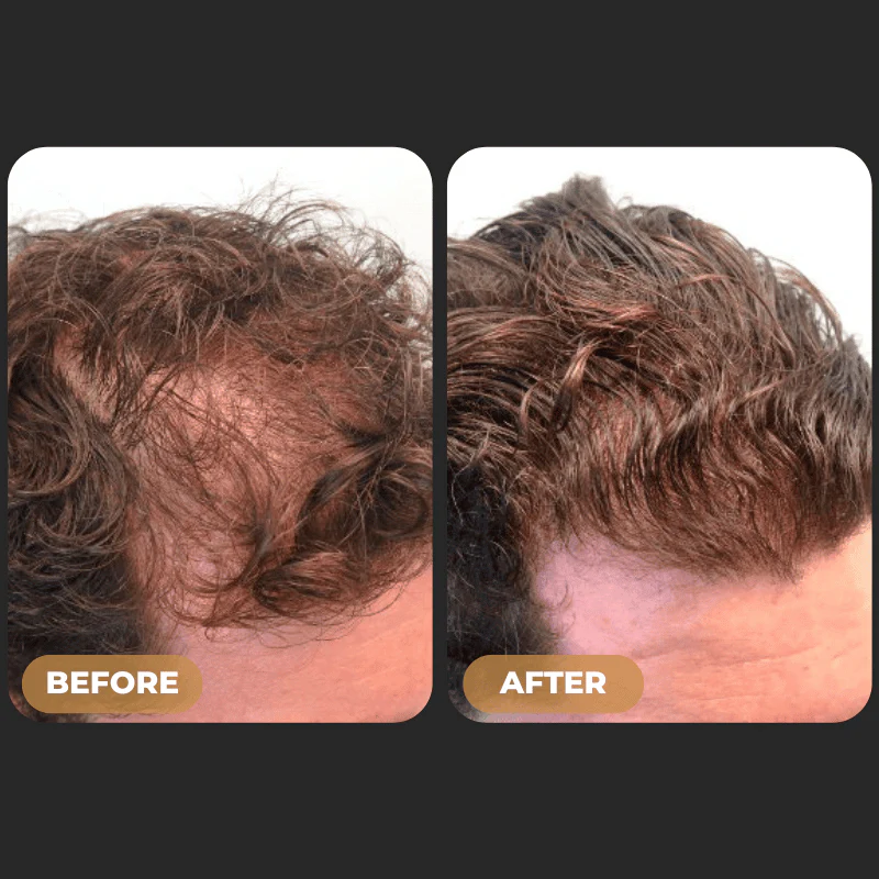 SPARTAN™ Root Activator Shampoo - Increased Hair Growth with Just 4 Washes a Week* - Image 3