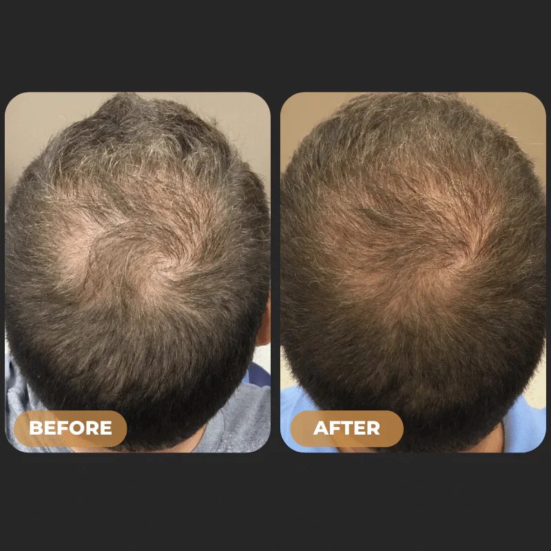 SPARTAN™ Root Activator Shampoo - Increased Hair Growth with Just 4 Washes a Week* - Image 4