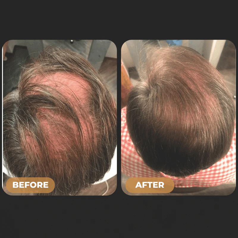 SPARTAN™ Root Activator Shampoo - Increased Hair Growth with Just 4 Washes a Week* - Image 5